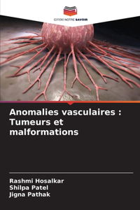 Anomalies vasculaires