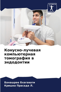 Конусно-лучевая компьютерная томография