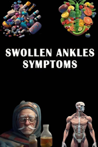 Swollen Ankles Symptoms