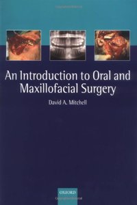 Introduction to Oral and Maxillofacial Surgery