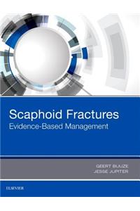 Scaphoid Fractures