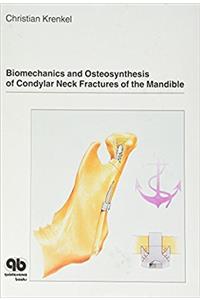 Biomechanics and Osteosynthesis on Condylar Neck Fractures of the Mandible