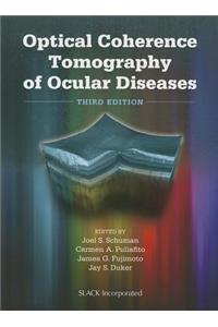 Optical Coherence Tomography of Ocular Diseases