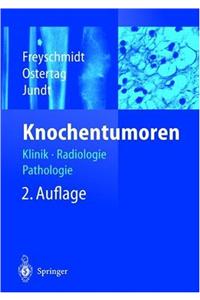 Knochentumoren: Klinik - Radiologie - Pathologie