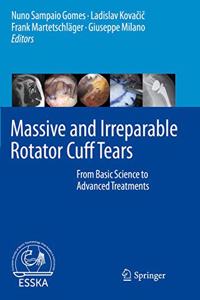 Massive and Irreparable Rotator Cuff Tears