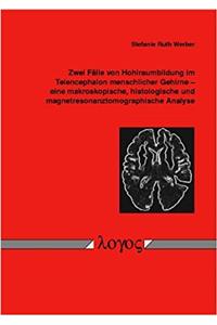 Zwei Falle Von Hohlraumbildung Im Telencephalon Menschlicher Gehirne - Eine Makroskopische, Histologische Und Magnetresonanztomographische Analyse