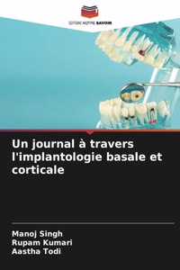 journal à travers l'implantologie basale et corticale