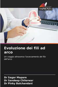 Evoluzione dei fili ad arco