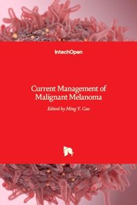 Current Management of Malignant Melanoma