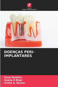 Doenças Peri-Implantares
