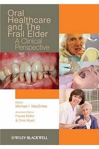 Oral Healthcare and the Frail Elder