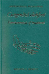 Congenital Clubfoot