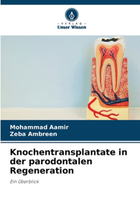Knochentransplantate in der parodontalen Regeneration