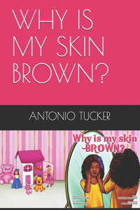 Why Is My Skin Brown?