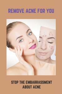 Remove Acne For You