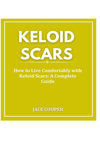 Keloid Scars