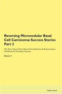 Reversing Micronodular Basal Cell Carcin