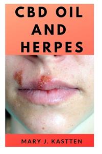 CBD Oil and Herpes