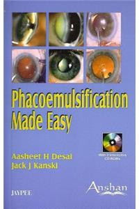 Phacoemulsification Made Easy