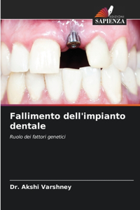 Fallimento dell'impianto dentale