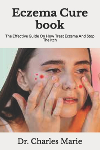 Eczema Cure book