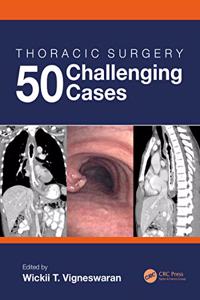 Thoracic Surgery: 50 Challenging Cases