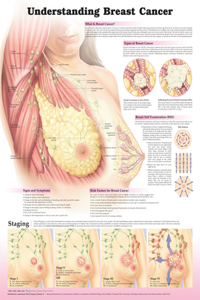 Understanding Breast Cancer 3e Laminated