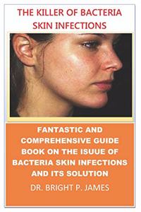 The Killer of Bacteria Skin Infection.