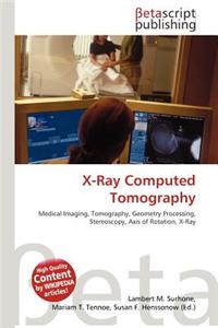 X-Ray Computed Tomography