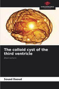 colloid cyst of the third ventricle