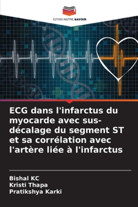 ECG dans l'infarctus du myocarde avec sus-décalage du segment ST et sa corrélation avec l'artère liée à l'infarctus