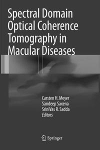 Spectral Domain Optical Coherence Tomography in Macular Diseases