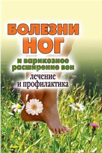 Diseases of the legs and varicose veins. Treatment and prevention