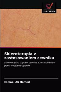 Skleroterapia z zastosowaniem cewnika