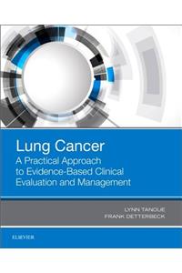 Lung Cancer: A Practical Approach to Evidence-Based Clinical Evaluation and Management