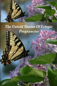 Untold Stories Of Ectopic Pregnancies