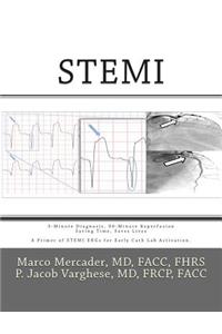 Stemi