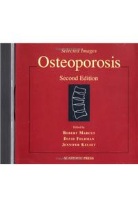 Osteoporosis, CD-ROM
