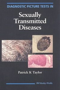 Diagnostic Picture Tests In Sexually Transmitted Diseases
