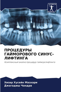 ПРОЦЕДУРЫ ГАЙМОРОВОГО СИНУС-ЛИФТИНГА