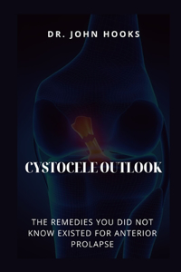 Cystocele Outlook