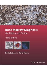 Bone Marrow Diagnosis