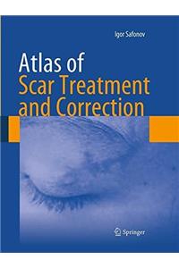 Atlas of Scar Treatment and Correction