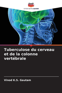 Tuberculose du cerveau et de la colonne vertébrale