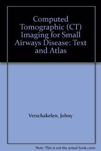 Computed Tomographic (CT) Imaging for Small Airways Disease
