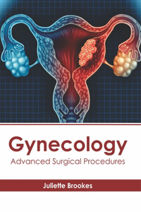 Gynecology: Advanced Surgical Procedures