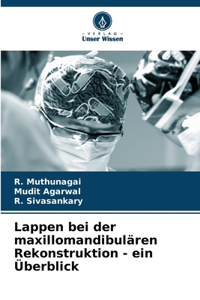 Lappen bei der maxillomandibulären Rekonstruktion - ein Überblick