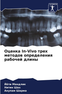 Оценка In-Vivo трех методов определения рабочk