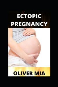 Ectopic Pregnancy