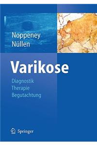 Diagnostik Und Therapie der Varikose